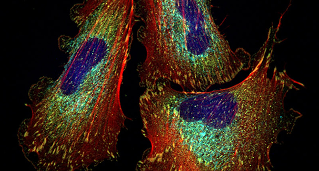 Microambiente da célula muscular lisa vascular